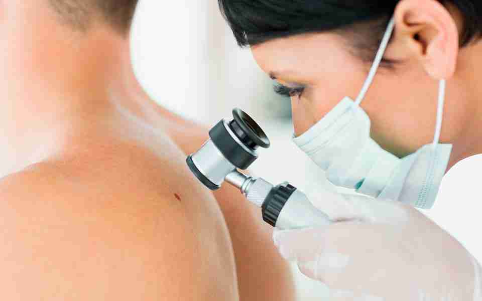 Psoriasis, mucho más que una enfermedad de la piel
